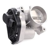 RIDEX Корпус дроссельной заслонки 158T0059